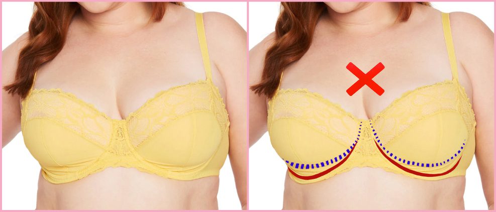 An example of a low-riding underwire