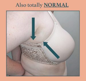 Some bra bans have more coverage