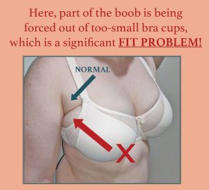 Extruded breast tissue is a fit problem